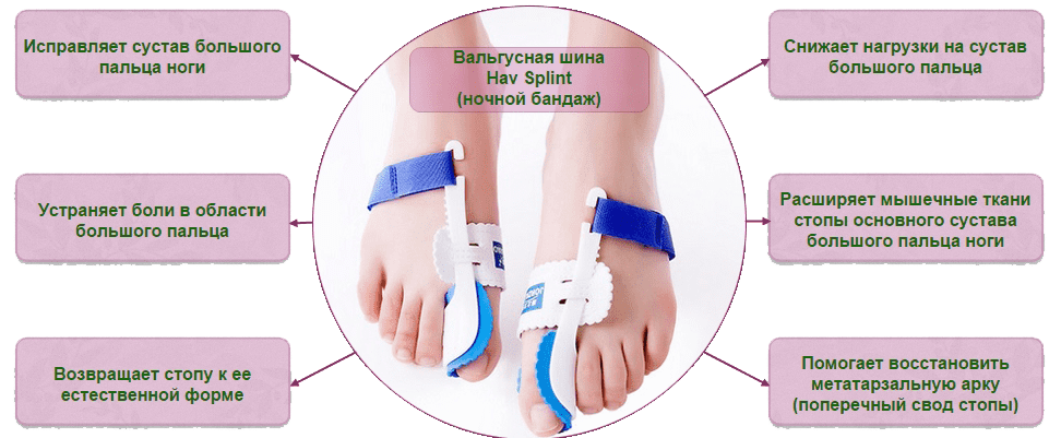 Ночной корректор. Вальгусный ночной бандаж hav Splint. Вальгусная шина hav Splint. Ortex 024 корректор большого пальца ноги отводящая шина. Ночной бандаж для коррекции большого пальца стопы.