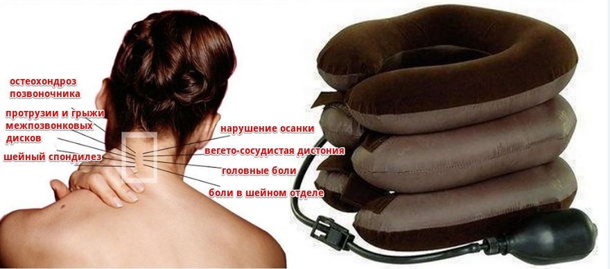 Воротник при грыже
