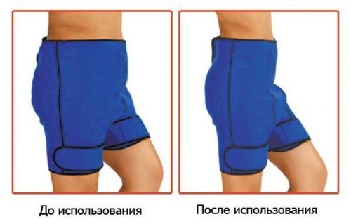Антицеллюлитные шорты для похудения картинки фото 3